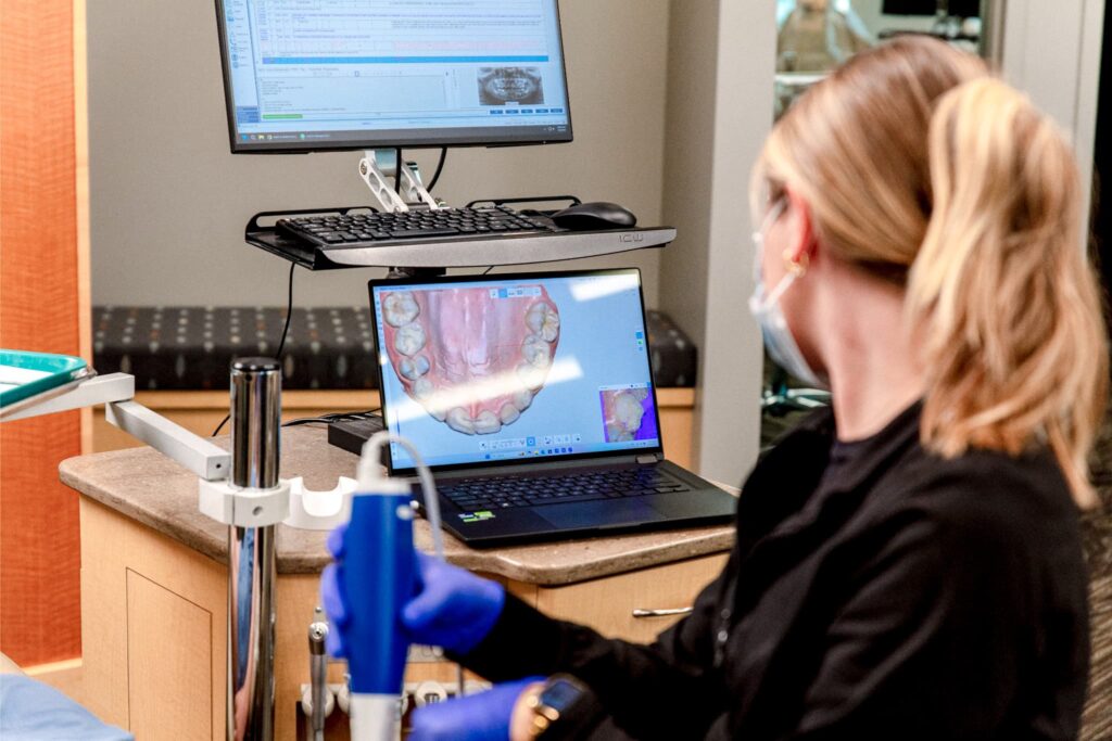 west fargo orthodontist—iTero-style scan for clear aligners